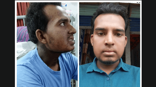 ক্যান্সারে আক্রান্ত খুবির প্রাক্তন শিক্ষার্থী মুজাহিদ
