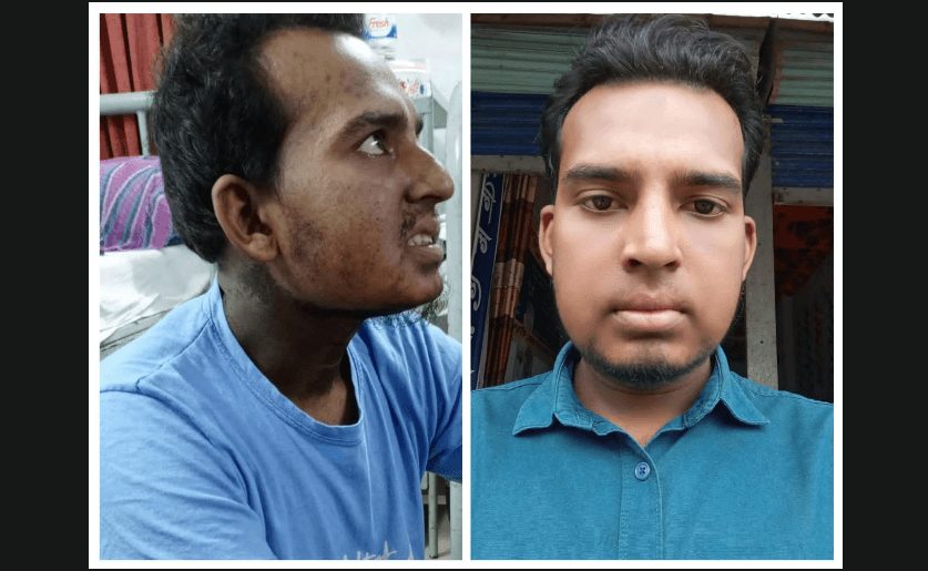 ক্যান্সারে আক্রান্ত খুবির প্রাক্তন শিক্ষার্থী মুজাহিদ
