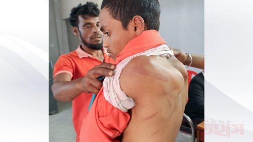 আহত মাদরাসা ছাত্র জিহাদ শেখ (১৪) | ছবি : দৈনিক ইতিহাস