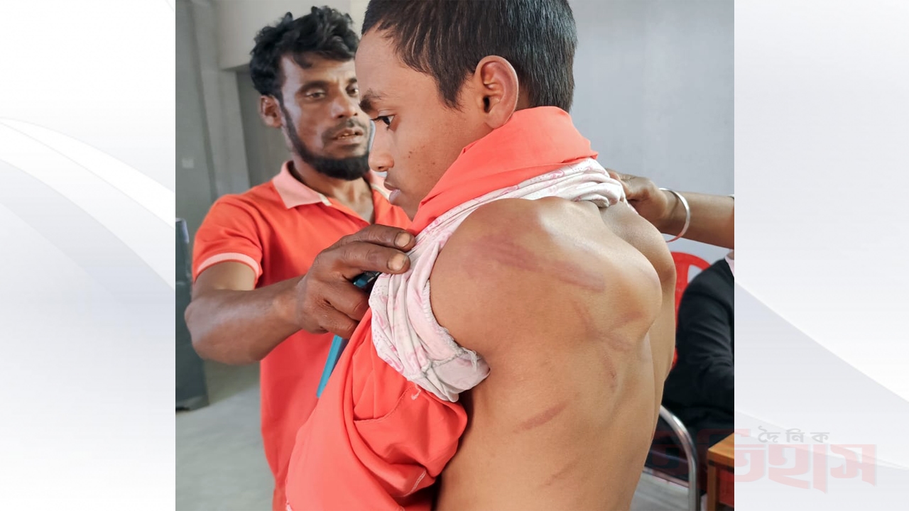 আহত মাদরাসা ছাত্র জিহাদ শেখ (১৪) | ছবি : দৈনিক ইতিহাস