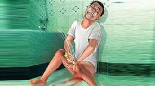 পুরুষাঙ্গ কাটা